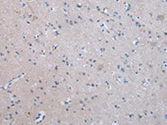 The image on the left is immunohistochemistry of paraffin-embedded Human brain tissue using COLEC12 Antibody(COLEC12 Antibody) at dilution 1/20, on the right is treated with synthetic peptide. (Original magnification: ×200)