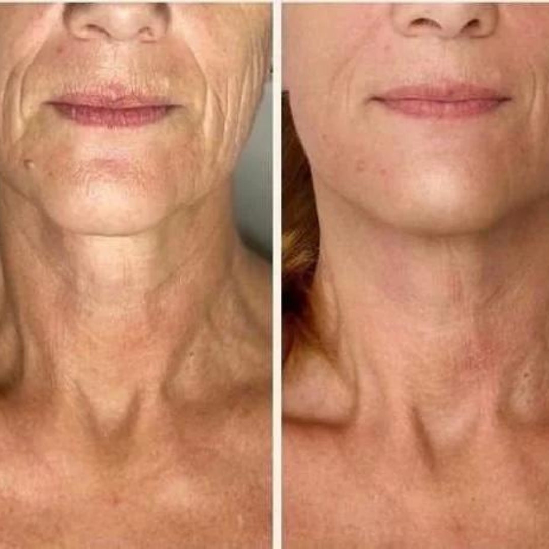 Jet Neck Add On
