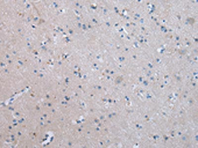 The image on the left is immunohistochemistry of paraffin-embedded Human brain tissue using COLEC12 Antibody(COLEC12 Antibody) at dilution 1/20, on the right is treated with synthetic peptide. (Original magnification: ×200)