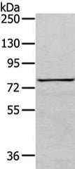 Gel: 6%SDS-PAGE, Lysate: 40 μg, Lane: K562 cell, Primary antibody: COLEC12 Antibody(COLEC12 Antibody) at dilution 1/200 dilution, Secondary antibody: Goat anti rabbit IgG at 1/8000 dilution, Exposure time: 3 minutes