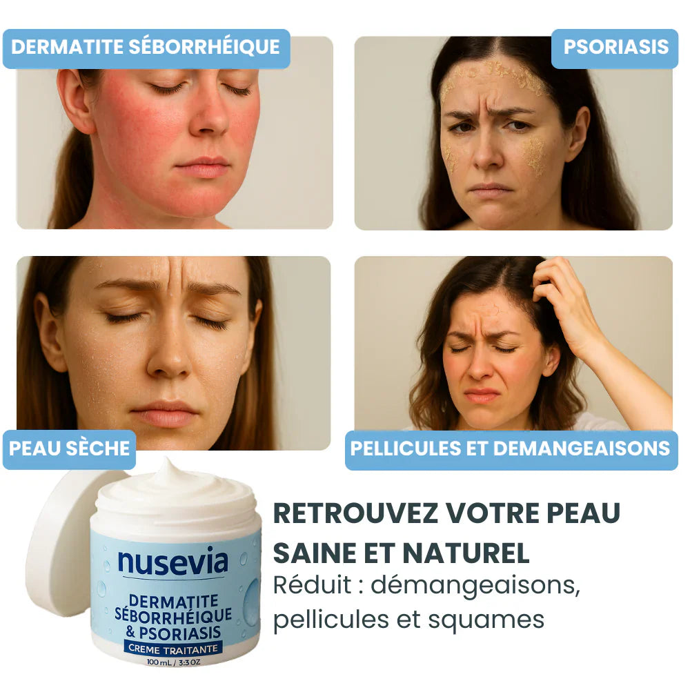 Crème Nusevia | Pour une peau nette, saine et apaisée - Cote D'ivoire