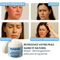 Crème Nusevia | Pour une peau nette, saine et apaisée - Cote D'ivoire